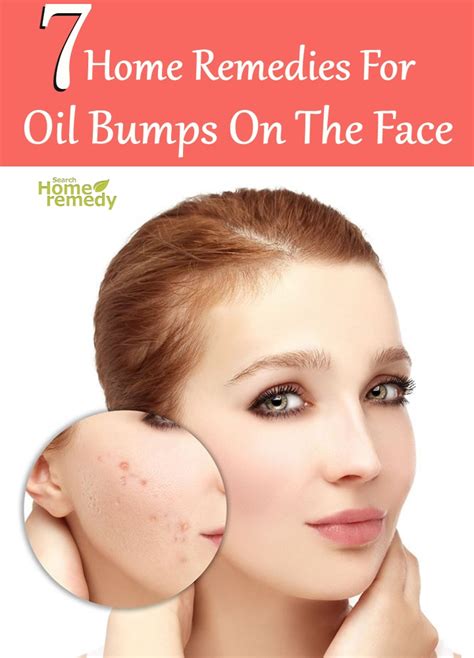 7 Best Home Remedies For Oil Bumps On The Face Search Home Remedy