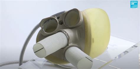 Carmat Artificial Heart Perfectly Mimics The Real Thing And Reduces