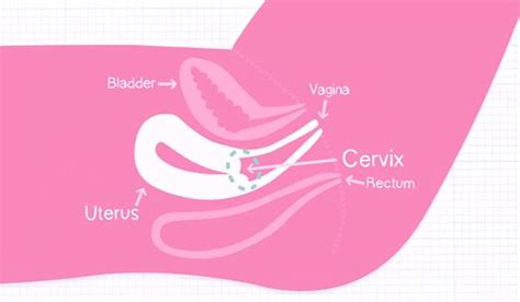 The Cervix Jos Cervical Cancer Trust