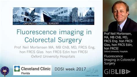 New Techniques And Tools Fluorescence Imaging In Colorectal Surgery