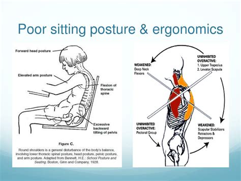 Ppt Gp Lecture Series 2013 The Shoulder Assessment Treatment And