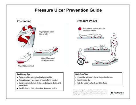 Pressure Ulcer Bed Sores Wound Care