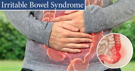Irritable Bowel Syndrome How To Recognize This Syndrome Longevity