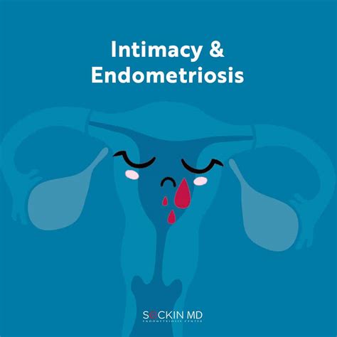 Sex And Endometriosis Seckin Endometriosis Center