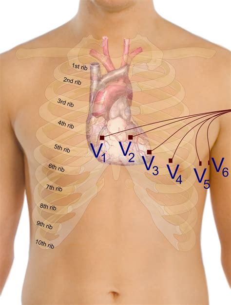 Electrocardiography ECG Medistudents