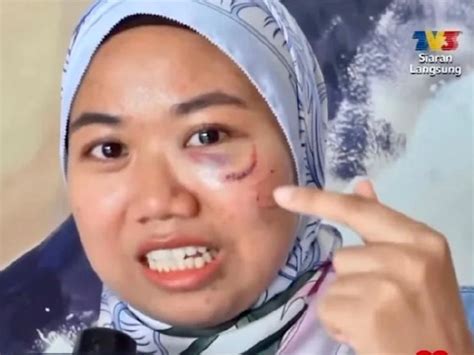 Nurul Shuhada Reveals The Reason She Got Punched By Hafidz Roshdi