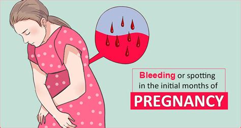 Causes And Warning Of Bleeding Or Spotting In The Initial Months Of Pregnancy