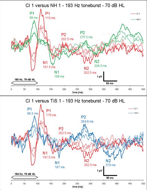Figure 15 From The Maturation Of Cortical Auditory Evoked Potentials In