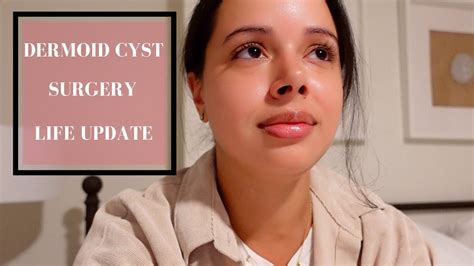 Life Update Ovarian Dermoid Cyst Symptoms And Surgery Youtube