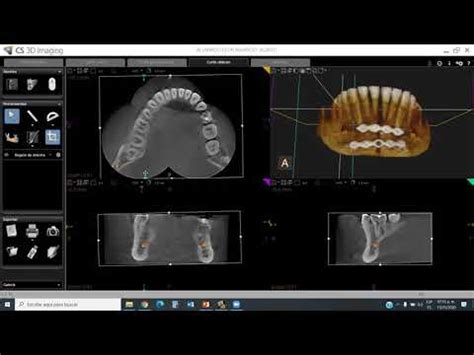 CS3D Carestream Manejo de software de Tomografía Cone Beam Dr Enrique
