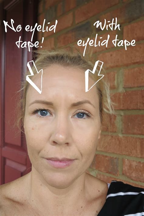 Maybe you would like to learn more about one of these? Eyelid tape for hooded eyes- does this really work?