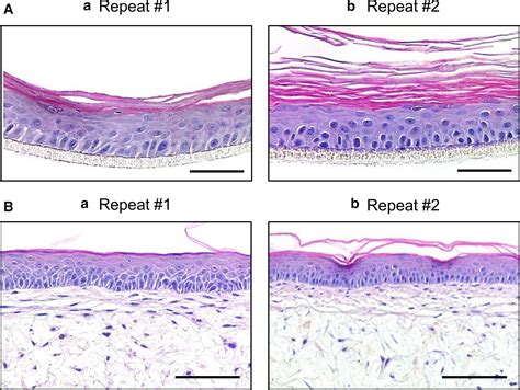 Human Skin Layers Histology