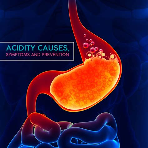 Acidity Signs Symptoms And Prevention