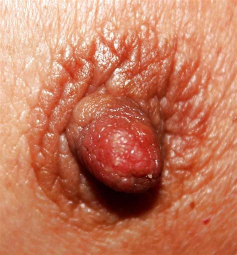 erect nipples porn pictures xxx photos sex images 1442928 pictoa