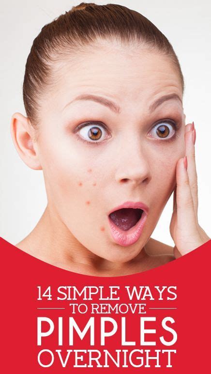 we heart it 14 simple ways to remove pimples overnight