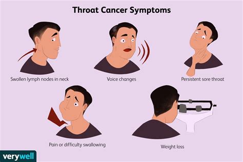 Throat Cancer Signs Symptoms Westside Head Neck My Xxx Hot Girl