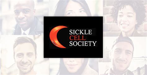Pain Management Guidelines For Sickle Cell Sickle Cell Society