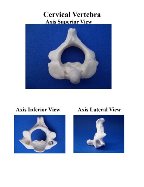 Axis Cervical Vertebrae Diagram Quizlet