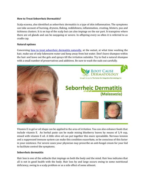 How To Treat Seborrheic Dermatitis By Root Cause Dermatology Issuu