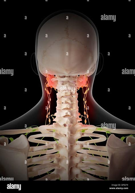 Painful Human Lymph Nodes Illustration Stock Photo Alamy