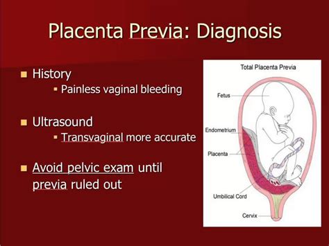 Pregnancy Discharge 3rd Trimester