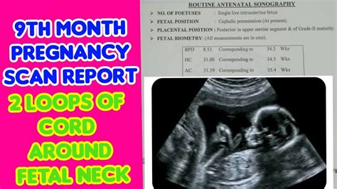 9th Month Pregnancy Scan Report In Teluguantenatal Scan Report9th Month Pregnancy Scan