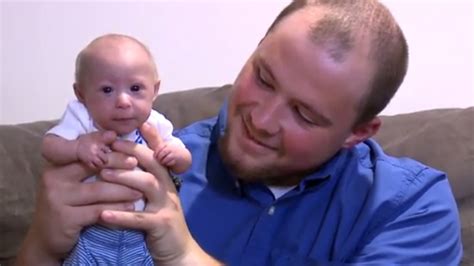Kentucky Baby Born With Rare Form Of Dwarfism
