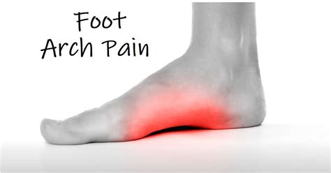 Arch Of Foot Pain On Bottom Hot Sex Picture