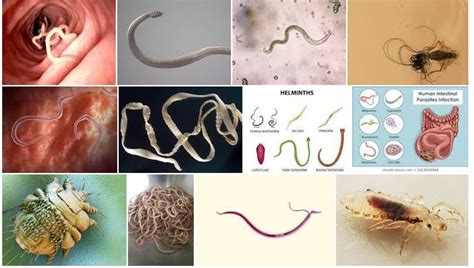 Understanding A Little More About Parasites