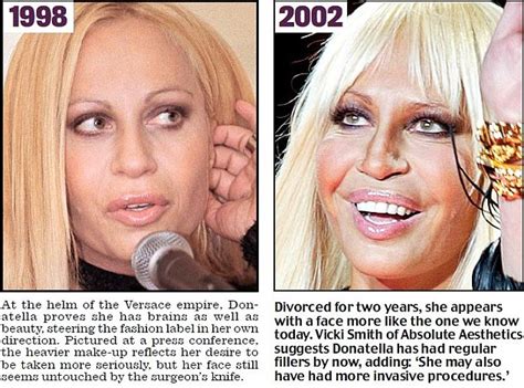 How Donatella Versace Destroyed Her Face With Plastic Surgery Naija Blog Queen Olofofo
