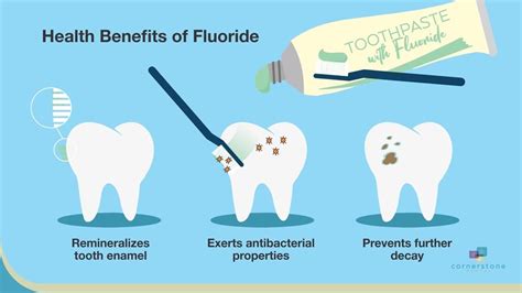 Fluoride Varnish Cornerstone Dental