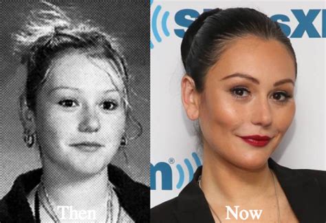 The stigma surrounding plastic surgery is disappearing as more mothers share their experiences, and why surgery was right for them. JWoww Plastic Surgery Before and After Photos - Latest ...