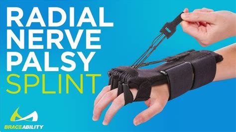 Dynamic Splint For Radial Nerve Palsy How To Use In Wrist 54 Off