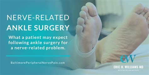 What To Expect From Nerve Related Ankle Surgery Post Surgical Pain