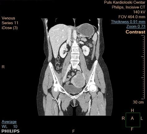 Abdominal And Pelvic CT Scanner Belgrade Pulse Cardiology Center