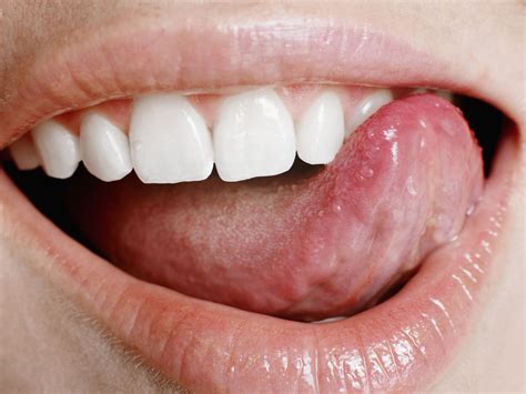 That Painful Sore On Your Tongue Is Actually A Canker Sore These Painful Babe Sores Which