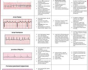 Cardiac Rhythm And Dysrhythmias Cheat Sheet Any Nurse Must Know For