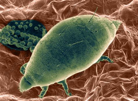 Broad Mite Larva Sem Stock Image C Science Photo Library