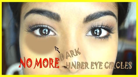 How To Conceal Dark Under Eye Circles Special Trick
