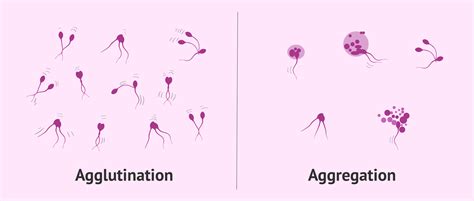 Agglutination Of Sperm Telegraph