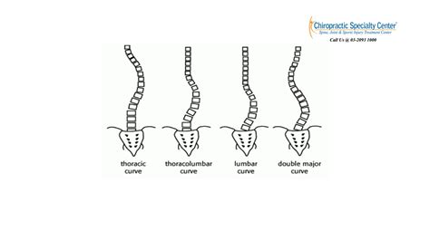 Non Surgical Treatment For Scoliosis In Malaysia