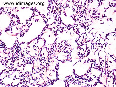 Clostridium Alchetron The Free Social Encyclopedia