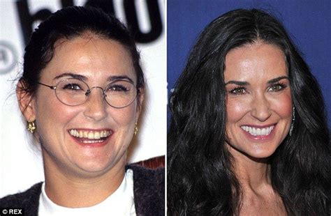 A Few Good Teeth But Now Demi Moore Has Lots Of Them Right The