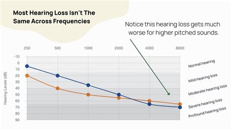How Much Do Hearing Aids Cost Up To Date Price List — Soundly