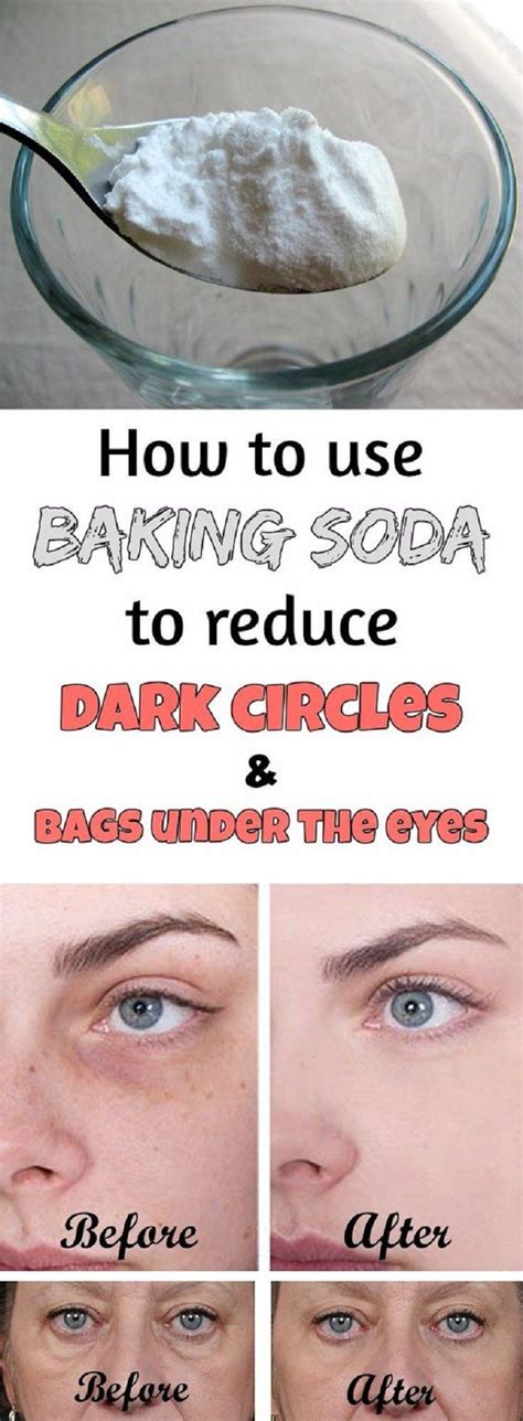 Dark Circles And Under Eye Bags Remedy With Baking Soda 7 All Natural