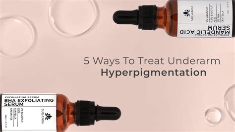 5 Ways To Treat Underarm Hyperpigmentation Suganda Skincare