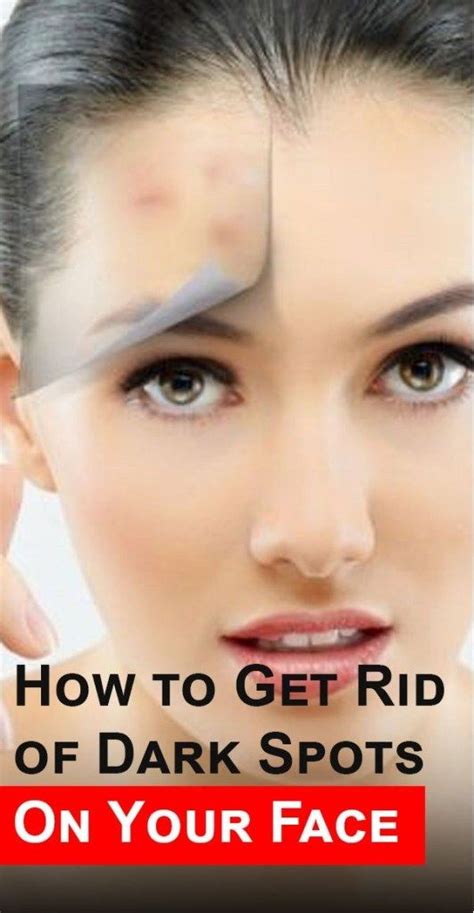 How To Get Rid Of Dark Spots On Your Face Brown Spots On Face Skin