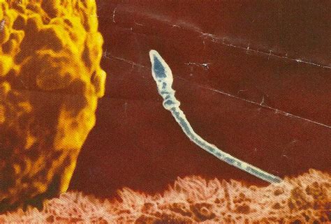The two anterior flagella, 12 μm in length. Is the Primary Cilium a Cell's Antenna or Its Brain