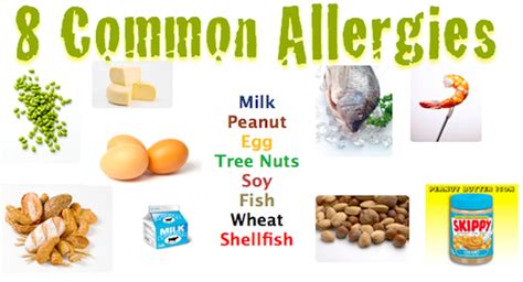 Common Food Allergies Med