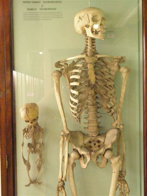 Baby Skeleton Anne Flickr